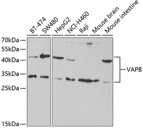 Anti-VAPB antibody used in Western Blot (WB). GTX32958