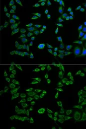 Anti-VAPB antibody used in Immunocytochemistry/ Immunofluorescence (ICC/IF). GTX32958