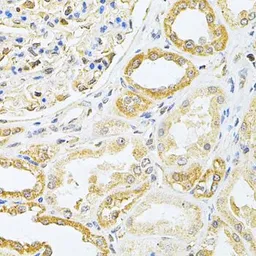 Anti-VAPB antibody used in IHC (Paraffin sections) (IHC-P). GTX32958