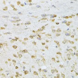 Anti-VAPB antibody used in IHC (Paraffin sections) (IHC-P). GTX32958