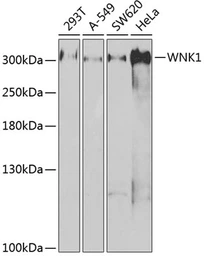 Anti-WNK1 antibody used in Western Blot (WB). GTX32973