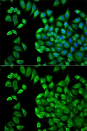 Anti-WNK1 antibody used in Immunocytochemistry/ Immunofluorescence (ICC/IF). GTX32973