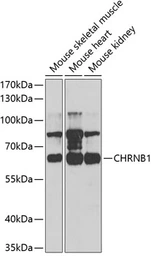 Anti-AChR beta 1 antibody used in Western Blot (WB). GTX32988