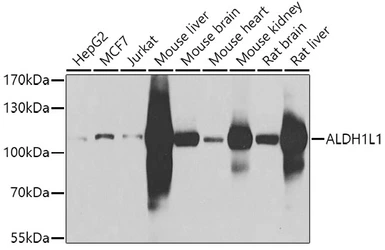 Anti-ALDH1L1 antibody used in Western Blot (WB). GTX32999