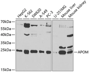 Anti-Apolipoprotein M antibody used in Western Blot (WB). GTX33015