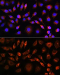 Anti-Apolipoprotein M antibody used in Immunocytochemistry/ Immunofluorescence (ICC/IF). GTX33015