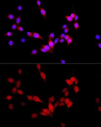 Anti-TUG antibody used in Immunocytochemistry/ Immunofluorescence (ICC/IF). GTX33023