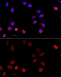 Anti-TUG antibody used in Immunocytochemistry/ Immunofluorescence (ICC/IF). GTX33023