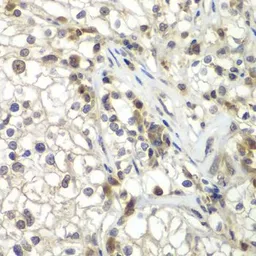 Anti-TUG antibody used in IHC (Paraffin sections) (IHC-P). GTX33023