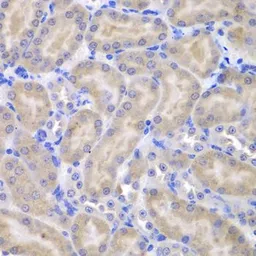 Anti-TUG antibody used in IHC (Paraffin sections) (IHC-P). GTX33023