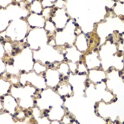 Anti-TUG antibody used in IHC (Paraffin sections) (IHC-P). GTX33023