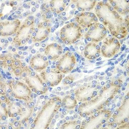 Anti-TUG antibody used in IHC (Paraffin sections) (IHC-P). GTX33023