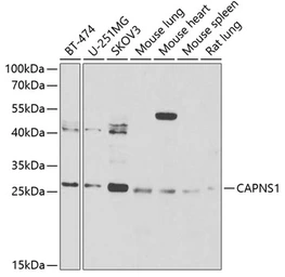 Anti-Calpain S1 antibody used in Western Blot (WB). GTX33058