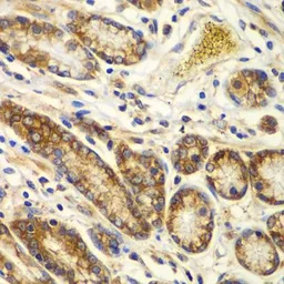 Anti-Calpain S1 antibody used in IHC (Paraffin sections) (IHC-P). GTX33058