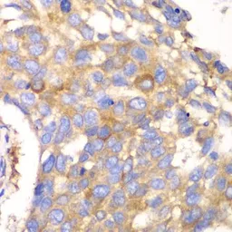 Anti-Calpain S1 antibody used in IHC (Paraffin sections) (IHC-P). GTX33058