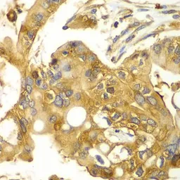 Anti-Calpain S1 antibody used in IHC (Paraffin sections) (IHC-P). GTX33058