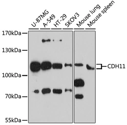 Anti-CDH11 antibody used in Western Blot (WB). GTX33082