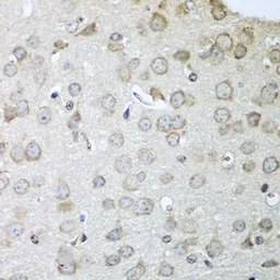 Anti-CDH11 antibody used in IHC (Paraffin sections) (IHC-P). GTX33082