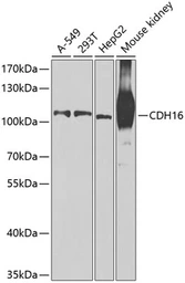 Anti-CDH16 antibody used in Western Blot (WB). GTX33083