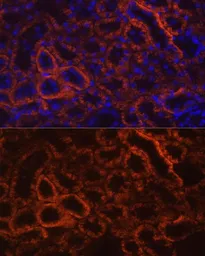 Anti-CDH16 antibody used in IHC (Paraffin sections) (IHC-P). GTX33083