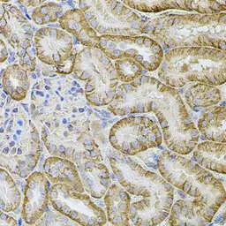 Anti-CDH16 antibody used in IHC (Paraffin sections) (IHC-P). GTX33083