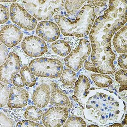 Anti-CDH16 antibody used in IHC (Paraffin sections) (IHC-P). GTX33083