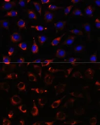 Anti-CYP17A1 antibody used in Immunocytochemistry/ Immunofluorescence (ICC/IF). GTX33134