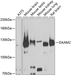 Anti-DAAM2 antibody used in Western Blot (WB). GTX33141