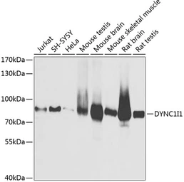 Anti-DYNC1I1 antibody used in Western Blot (WB). GTX33166