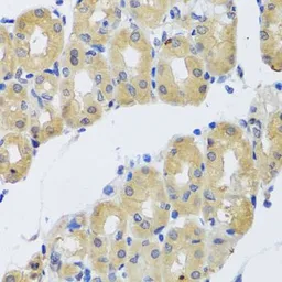 Anti-DYNC1I1 antibody used in IHC (Paraffin sections) (IHC-P). GTX33166