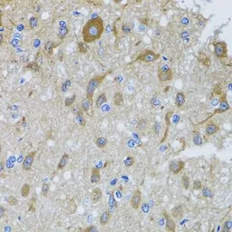 Anti-DYNC1I1 antibody used in IHC (Paraffin sections) (IHC-P). GTX33166