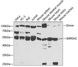 Anti-IMPDH2 antibody used in Western Blot (WB). GTX33264