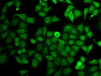 Anti-IMPDH2 antibody used in Immunocytochemistry/ Immunofluorescence (ICC/IF). GTX33264