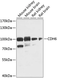 Anti-K-Cadherin antibody used in Western Blot (WB). GTX33279