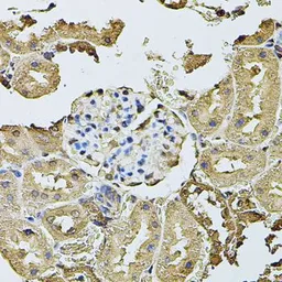 Anti-K-Cadherin antibody used in IHC (Paraffin sections) (IHC-P). GTX33279