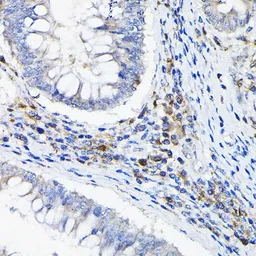 Anti-LILRB4 antibody used in IHC (Paraffin sections) (IHC-P). GTX33296