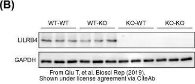 Anti-LILRB4 antibody used in Western Blot (WB). GTX33296