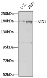 Anti-Nidogen 1 antibody used in Western Blot (WB). GTX33357