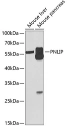 Anti-Pancreatic Lipase antibody used in Western Blot (WB). GTX33384