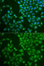 Anti-Pancreatic Lipase antibody used in Immunocytochemistry/ Immunofluorescence (ICC/IF). GTX33384