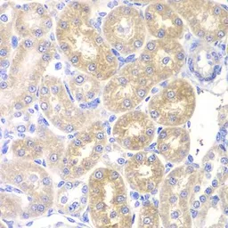 Anti-Pancreatic Lipase antibody used in IHC (Paraffin sections) (IHC-P). GTX33384