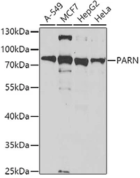 Anti-PARN antibody used in Western Blot (WB). GTX33386