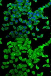 Anti-PARN antibody used in Immunocytochemistry/ Immunofluorescence (ICC/IF). GTX33386