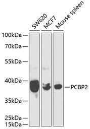 Anti-PCBP2 antibody used in Western Blot (WB). GTX33389