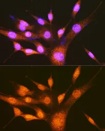 Anti-PCBP2 antibody used in Immunocytochemistry/ Immunofluorescence (ICC/IF). GTX33389