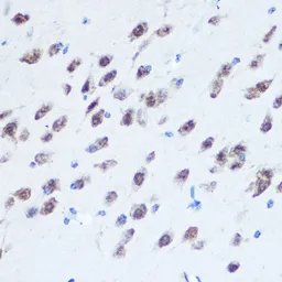 Anti-PCBP2 antibody used in IHC (Paraffin sections) (IHC-P). GTX33389