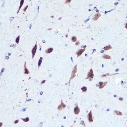 Anti-PCBP2 antibody used in IHC (Paraffin sections) (IHC-P). GTX33389