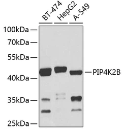 Anti-PIP4K2B antibody used in Western Blot (WB). GTX33410