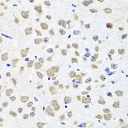 Anti-PIP4K2B antibody used in IHC (Paraffin sections) (IHC-P). GTX33410