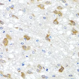 Anti-PIP4K2B antibody used in IHC (Paraffin sections) (IHC-P). GTX33410